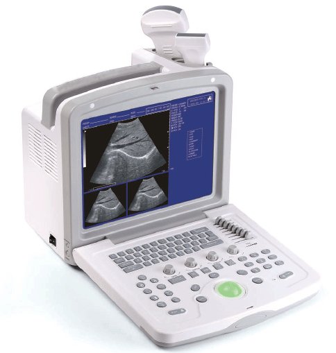 Portable convexb-ultrasound scanner ultrasound machine