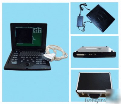 Digital smart book ultrasound scanner cms-600P