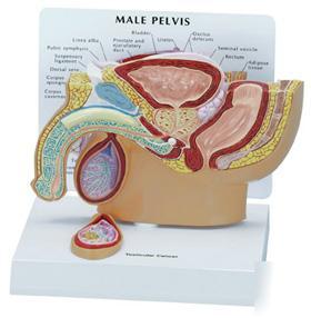 New anatomical male pelvis w/ testicular cancer