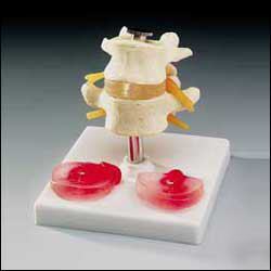 New lumbar with interchangeable disks brand 