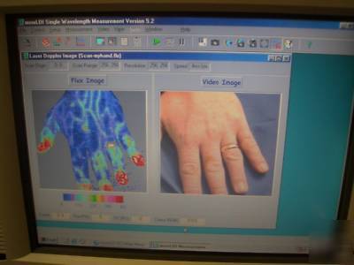 Moor LD12 ir laser doppler imaging system MOORLD12IR
