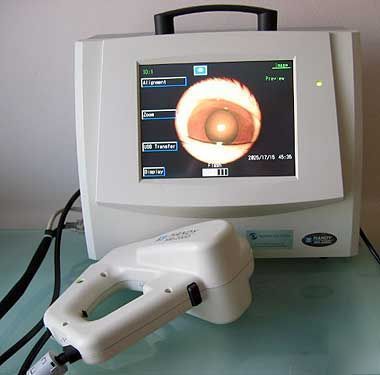 Used retinal camera non-mydiatric nidek nm-200D digital