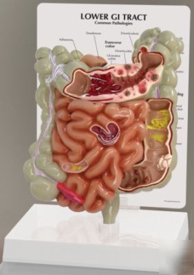 Gi tract human anatomical model cutaway #3342 frees&h*