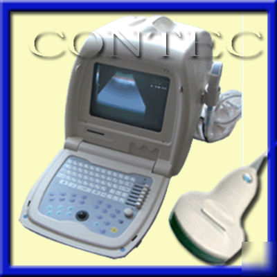  portable ultrasound scanner ultrasound 3.5MHZ convex