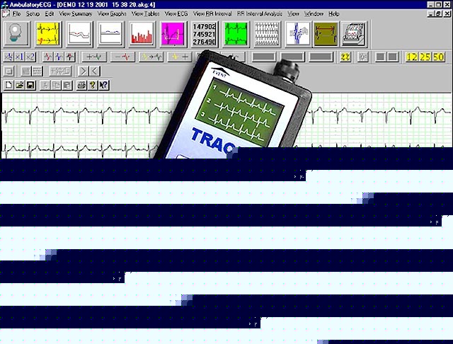 New holter ecg program + digital recorder