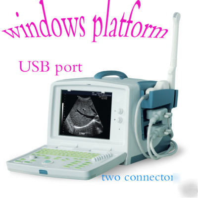 Full digital ultrasound system+ convex and transvaginal