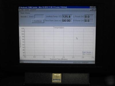 Medtronic tuna therapy model 7900 urodynamic system