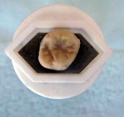 Lot of vita VMK68 and VMK95 porcelain - 106 bottles ttl