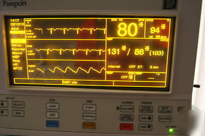 Datascope passport el amber 5 l ecg SP02 ibp clean