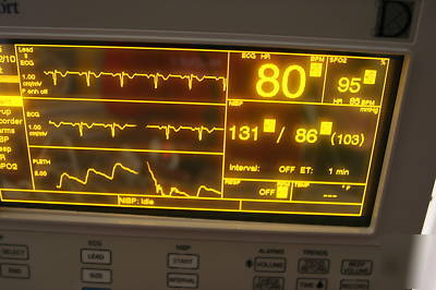 Datascope passport el amber 5 l ecg SP02 ibp clean