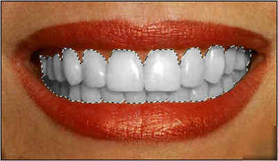 Professional teeth whitening website & domain for sale 