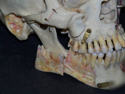 Real human skull for medical/dental study,bone,skeleton