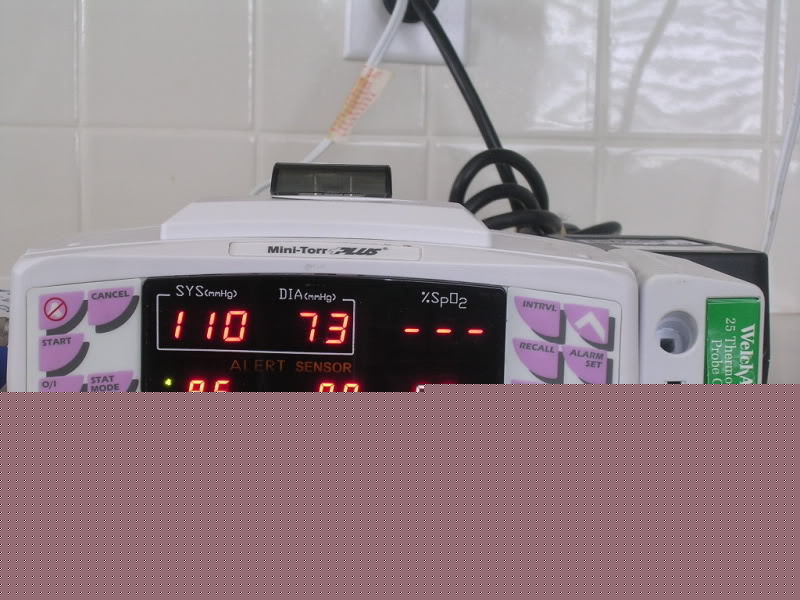 Nib bci mini-torr plus p pulse SPO2 monitor printer