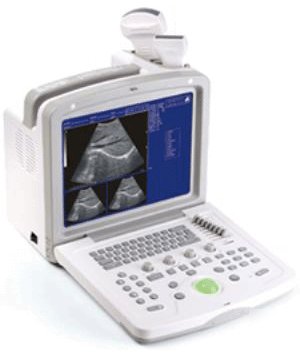 Digital portable b-ultrasound ultrasound linear probe