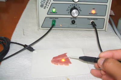 Ellman surgitron ffpf emc electrosurgical unit/nice 