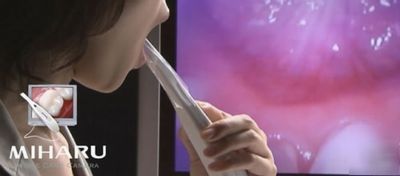 Miharu - dental intraoral camera with plaque detection