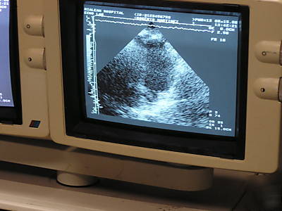 Toshiba sonolayer ssh-160 diagnostic ultrasound 