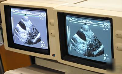 Toshiba sonolayer ssh-160 diagnostic ultrasound 