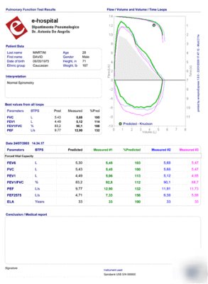New spirobank spirometer with pc software and supplies 
